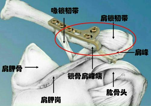 肩锁关节挫伤与脱位是什么症状和表现用中医来解释