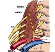 前斜角肌综合征是什么症状和表现用中医来解释