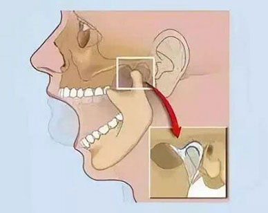 颞颌关节炎是什么症状和表现用中医来解释