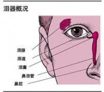 溢泪症是什么症状和表现用中医来解释