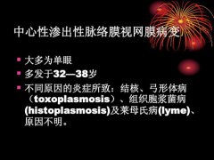 中心性视网膜脉络膜炎是什么症状和表现用中医来解释