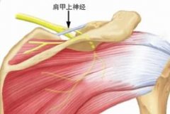 RSI是什么？重复性压迫损伤或过度使用综合征