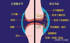 骨关节保养有什么好处_保养骨骼的重要性有哪些