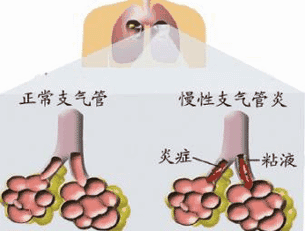 气管疼痛是什么原因图片