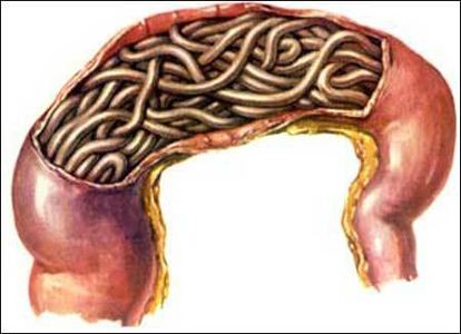 蛔虫病的症状临床表现 中医蛔虫病怎么办治疗 古中药养生网