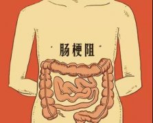 急性肠梗阻是什么症状和表现用中医来解释