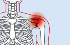 肩袖损伤是什么症状和表现用中医来解释