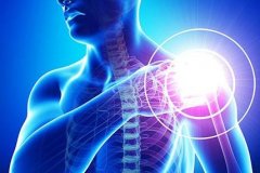 肩峰下滑囊炎是什么症状和表现用中医来解释