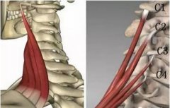 肩胛提肌劳损是什么症状和表现用中医来解释