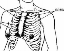 胸肋软骨炎是什么症状和表现用中医来解释