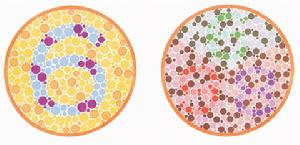 色觉障碍是什么症状和表现用中医来解释