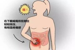 阑尾炎的症状_阑尾炎的治疗