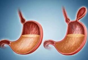 胃泌素是怎样产生的?它对胃液分泌有什么作用?