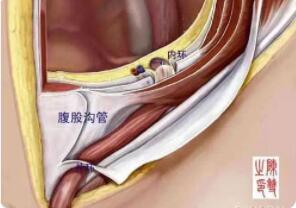 什么是腹股沟管?它是怎么构成的?
