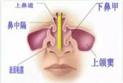 什么是鼻窦?鼻窦的解剖特点在临床上有什么意义?