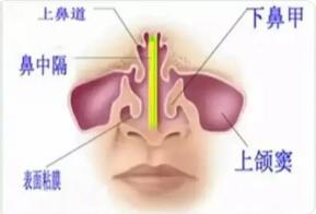 什么是鼻窦?鼻窦的解剖特点在临床上有什么意义?