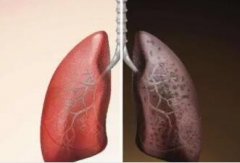 什么是肺通气量?为什么快而浅的呼吸也会造成缺氧?