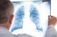 什么是胸式呼吸和腹式呼吸?各有哪些临床意义?